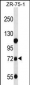 GUSB Antibody (C-term)